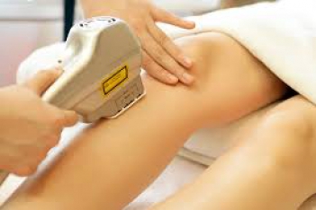Triệt lông vĩnh viễn ở tay an toàn - hình ảnh