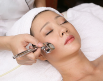 Lời khuyên cho việc tự áp dụng lăn kim trị sẹo lõm - hình ảnh